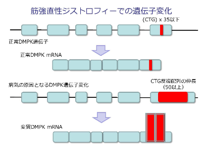 筋強直性ジストロフィーでの遺伝子変化