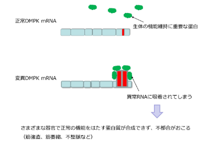 MBNLがヘアピンの部分に吸着