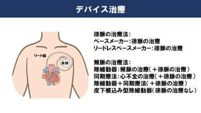 デバイス治療